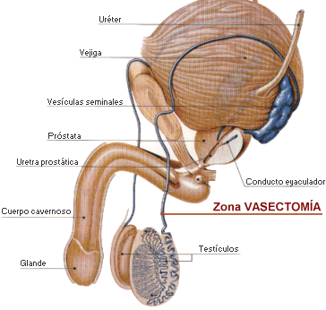 Aparato urogenital masculino. Zona de vasectomía